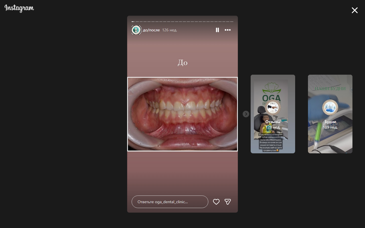 Состояние зубов до лечения — кейс 1