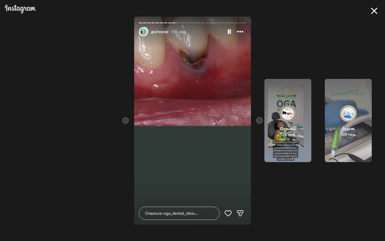 Результат после лечения — кейс 5