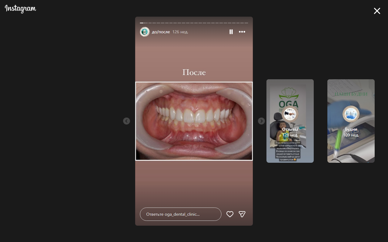 Результат после лечения — кейс 1
