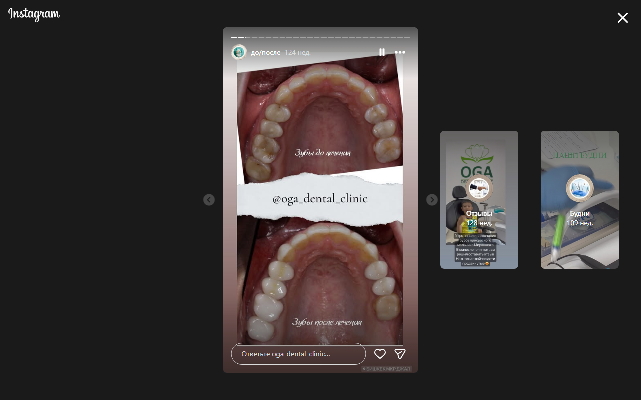 Состояние зубов до лечения — кейс 2