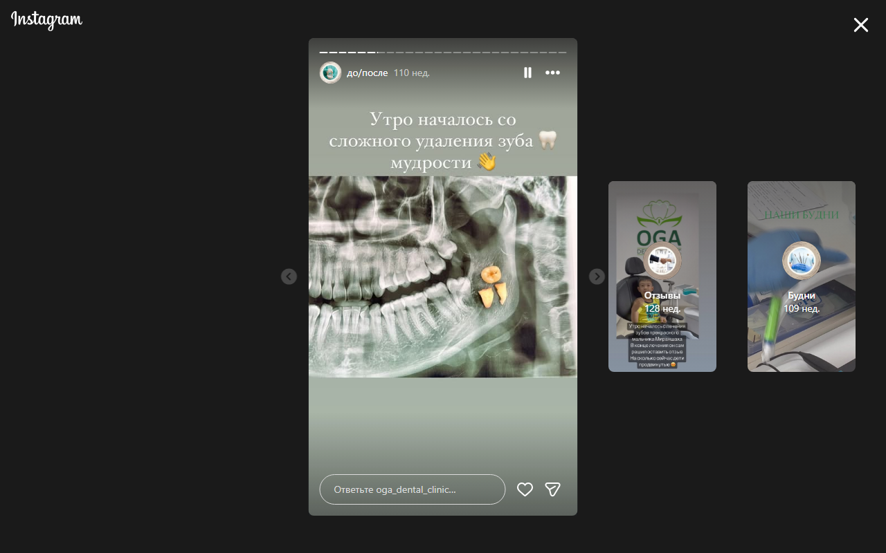 Состояние зубов до лечения — кейс 4
