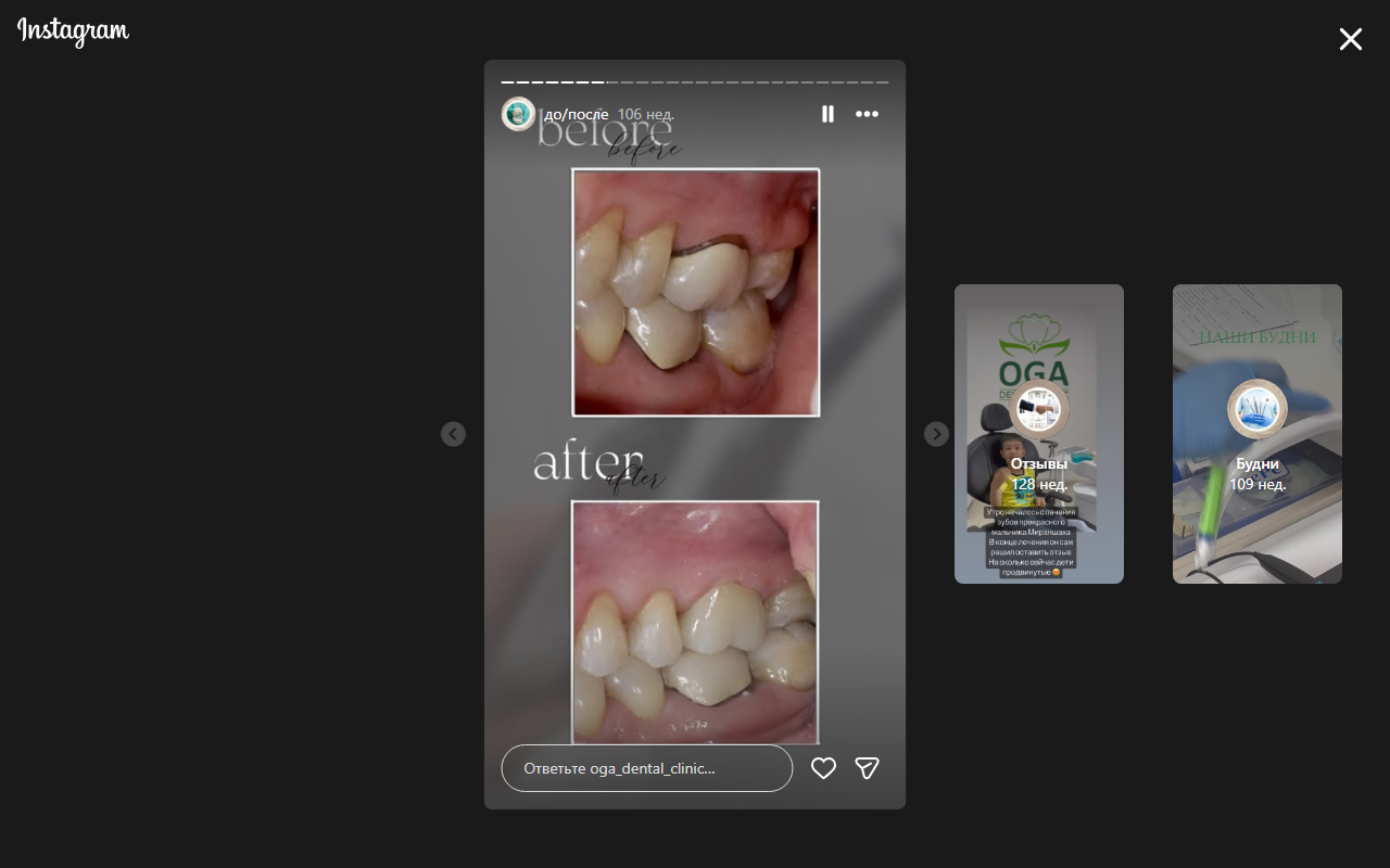 Результат после лечения — кейс 4