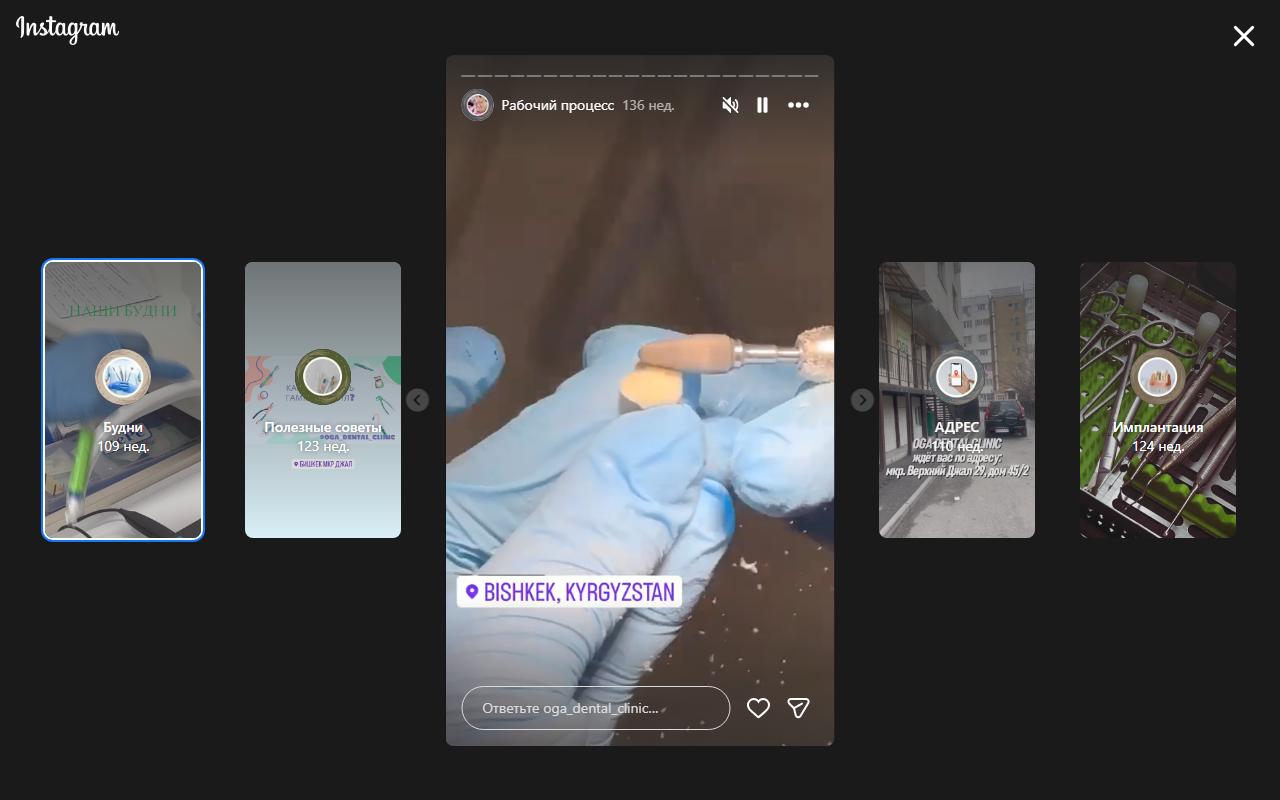 Лечение зубов — пломбирование в OGA Dental Clinic