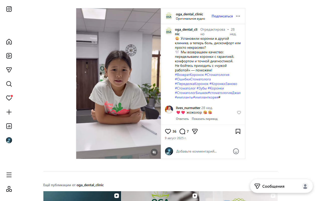 Переделка коронок из других клиник — коррекция чужих работ