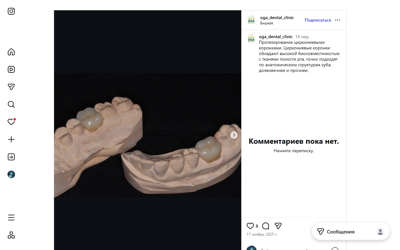 Циркониевые коронки и протезирование